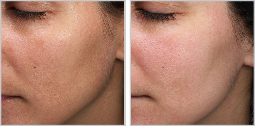 Cutizone skin and laser clinic clearance
