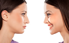 Non Surgical Rhinoplasty Williamsport PA