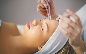 SkinPen Microneedling Williamsport PA