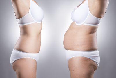 Smartlipo Williamsport PA