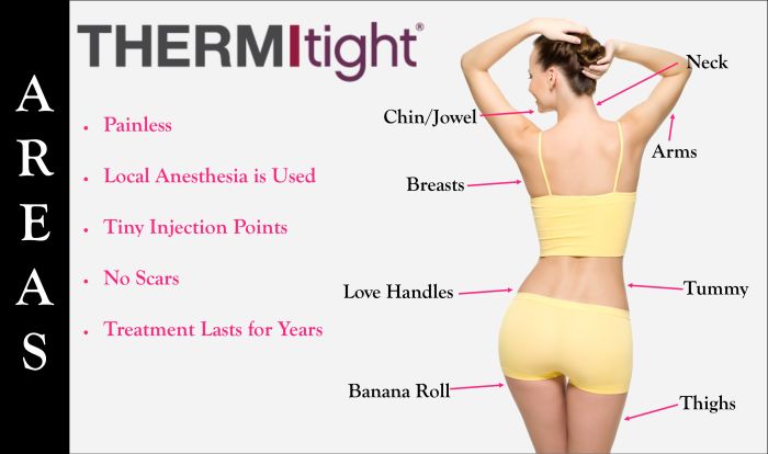 Thermitight Treatment Areas